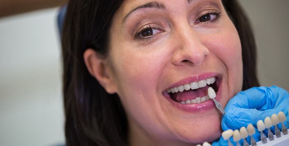 Dental Crowns